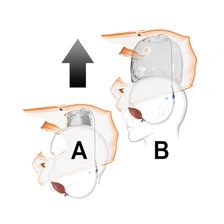 Eject Bladder image 4